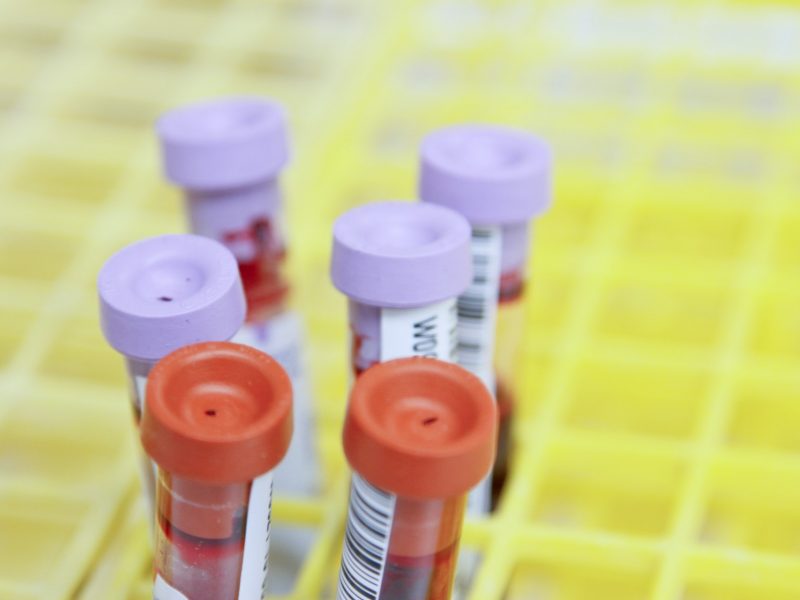 Zájemců o darování krevní plazmy ve Vsetínské nemocnici meziročně přibývá