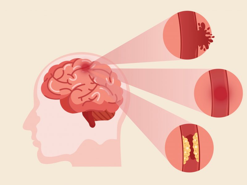 The Guardian: Experti navrhují rutinní vyšetření mozku u nových případů psychózy