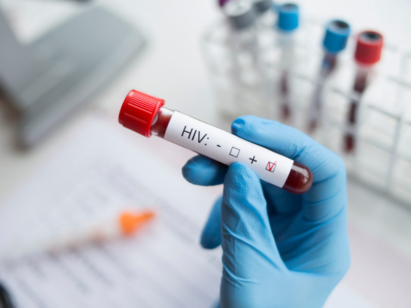 Lidé se mohou do neděle zdarma otestovat na HIV a žloutenku