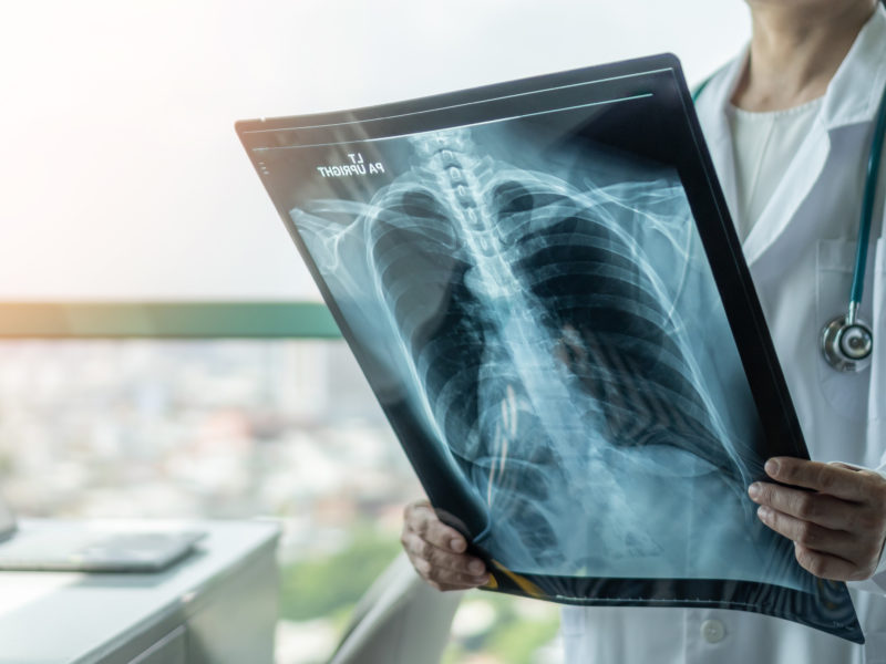 Slezská nemocnice v Opavě má nové rentgeny za deset milionů korun