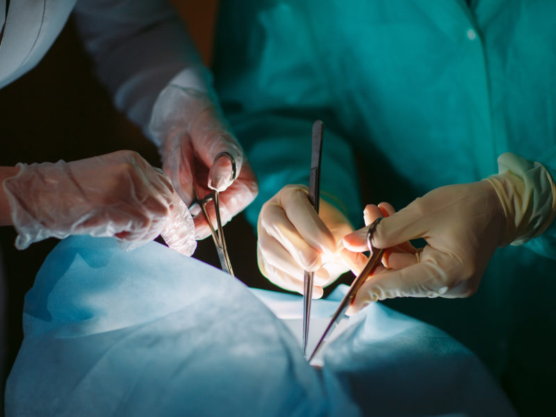 Nemocnice Přerov pořídila přístroje na transplantaci kůže i detekci metastáz