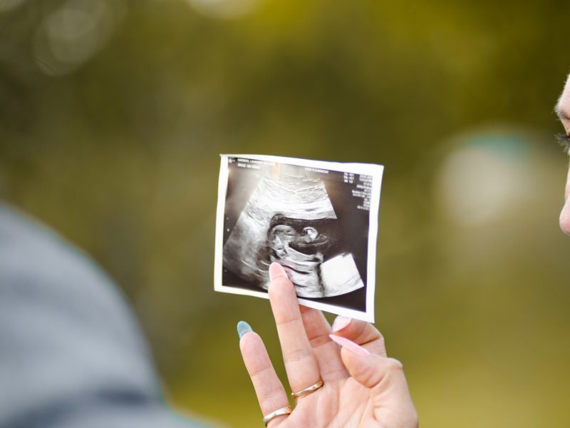 V USA po zákazu potratů prudce roste počet sterilizací, ukázala studie